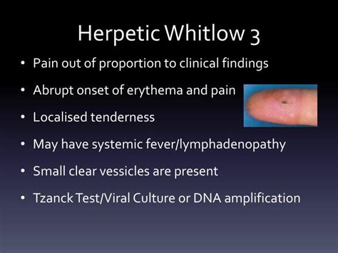 Ppt Hand Infections Powerpoint Presentation Id4624020