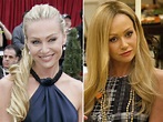 Portia de Rossi Plastic Surgery Before And After Photos