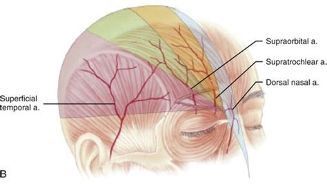 Interpolated Paramedian Forehead Flaps Pocket Dentistry