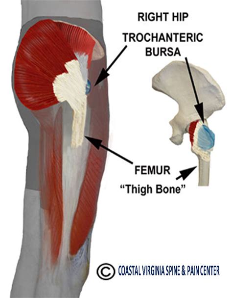 What Is Trochanteric Bursitis Healthy Ask Images And Photos Finder