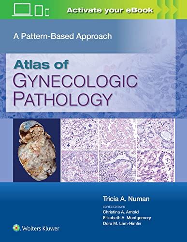 Atlas Of Gynecologic Pathology A Pattern Based Approach By Numan Md
