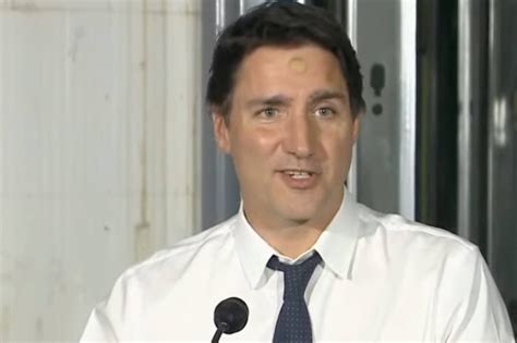 Canadians Wonder What Happened To Justin Trudeau S Forehead