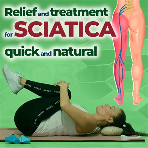 Relief And Treatment For Sciatica Quick And Natural Cordus United States