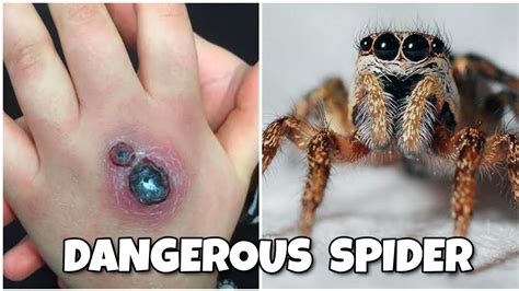 Top 10 Most Venemous Spiders In The World 2020 Youtube