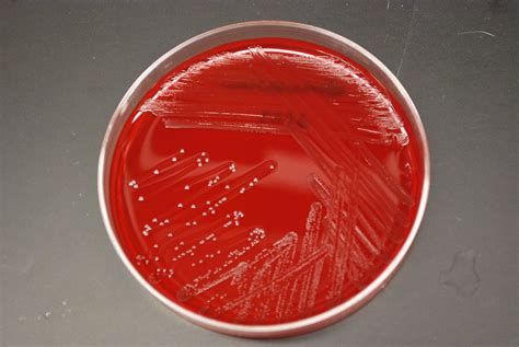 Enterococcus Faecalis E Faecalis Appear As Small Round Flickr