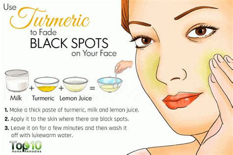 10 Home Remedies To Get Rid Of Dark Spots On Face Top 10 Home Remedies