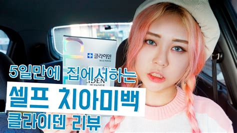 셀프치아미백 5일만에 집에서 할 수 있는 클라이덴 리뷰 eunbi ц gongquiz blog