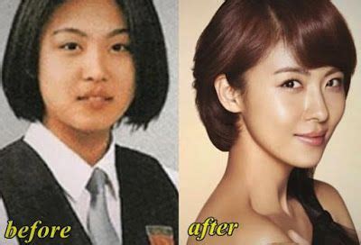 Ha Ji Won Plastic Surgery Before And After Video Bokep Ngentot