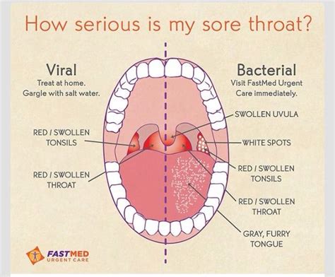 👍what Does Your Sore Throat Mean👍 Health Medical Health Resources