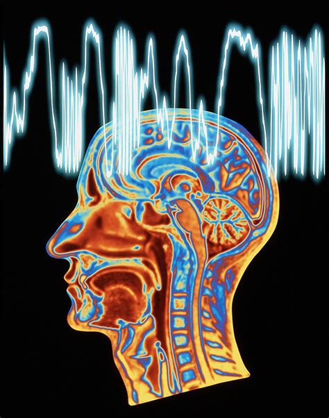 Epilepsie Ausgrenzung Oft Schlimmer Als Krankheit Selbst Neurologie