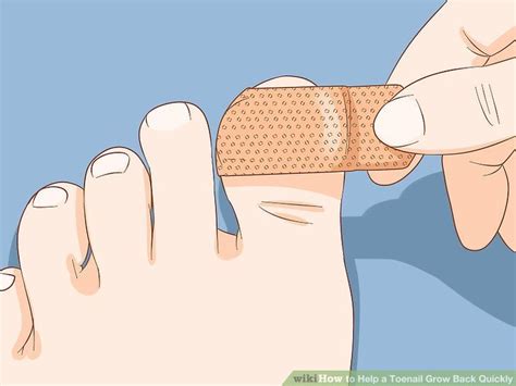 How To Help A Toenail Grow Back Quickly Toe Nails Broken Toenail