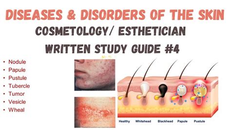 Cosmetology Written Study Guide 4 Diseases And Disorders Of The Skin