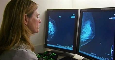 Do False Positive Mammograms Increase Your Risk Of Breast Cancer