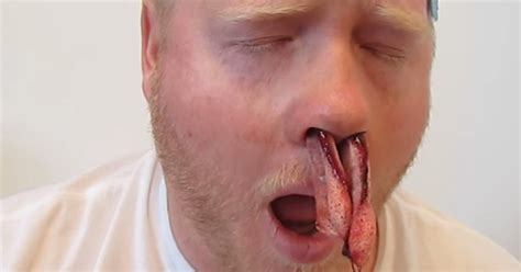 video nojento homem  nariz muito entupido encontra alivio