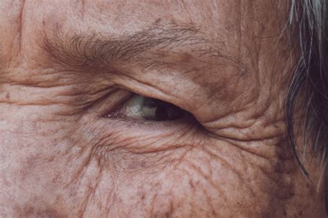 Skin Care For The Elderly Livestrongcom