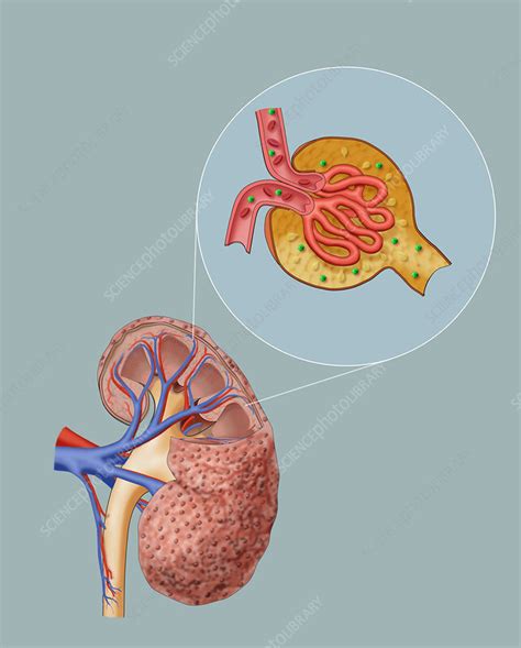 Chronic Kidney Disease And Glomerulus Stock Image C0445877