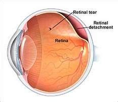 Must contain at least 4 different symbols; 17 Best images about Eye Facts on Pinterest | Healthy eyes ...