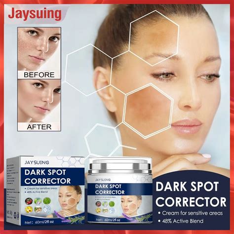 Jaysuing Whitening Freckle Cream Facial Dark Spot Removal Lighten Spots Skin Relief Melanosis