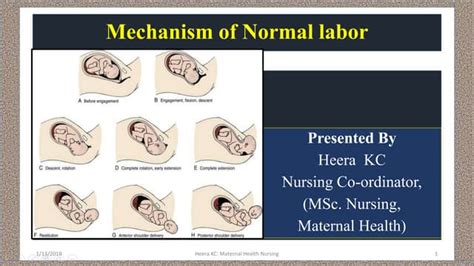 Mechanism Of Normal Labor Ppt