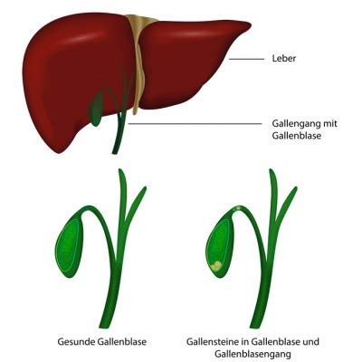 Die gallenblase stellt einen hohlkörper dar, welcher unterhalb der leber gelegen ist und sich in einer art geschützten grube befindet. Gallenblase (Galle) - Funktion, Aufbau & Beschwerden ...