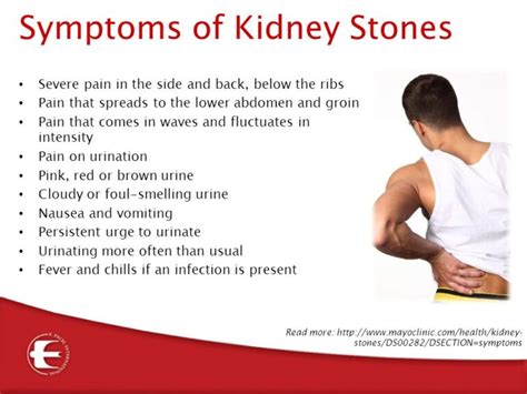 What Are The Symptoms Of Kidney Stones Timeslifestyle