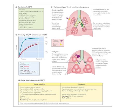 Chronic Obstructive Pulmonary Disease Pediagenosis