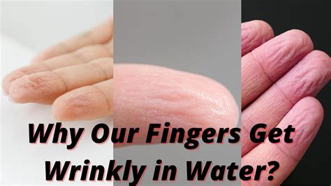 why our fingers get wrinkly in water [intresting answer of why our fingers get wrinkly in water