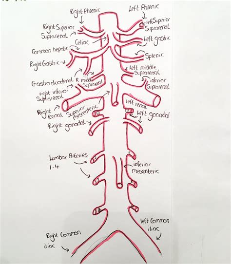 Abdominal Aortic Branches Anatomy Aorta Taming The Sru Intimal Tear