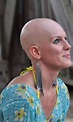 18 best Bald is Beautiful images on Pinterest | Bald women, Short ...