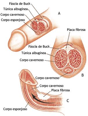 Definicion las enfermedades pulmonares intersticiales, también conocidas como enfermedades pulmonares parenquimatosas difusas, resultan del daño de las células que rodean los alvéolos. ¿Sabía usted que ...?