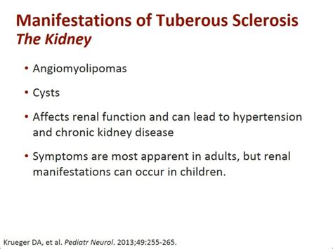 Ppt Tuberous Sclerosis Complex Fundamental Concepts In Diagnosis And