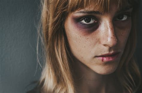 Premium Photo Stop Violence Against Women Sad Beaten Up Girl With