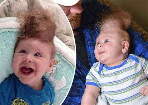 Yes, cancer is due to genetic changes, but that doesn't generally mean it's inherited. Baby Born With Brain Outside Skull Defies The Odds