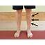 How To Prevent Shin Splints  The Physical Therapy Advisor
