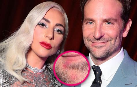 Der Chirurg Warum Nicht Eilen Bradley Cooper Kiss Lady Gaga Stelle