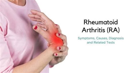 What Are The Various Stages Of Rheumatoid Arthritis Ra