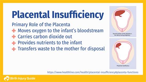 Placental Insufficiency Pregnancy And Birth Birth Injury Guide