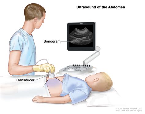 Protocoling Imaging Studies Complete Abdominal Ultrasound Ultrasound