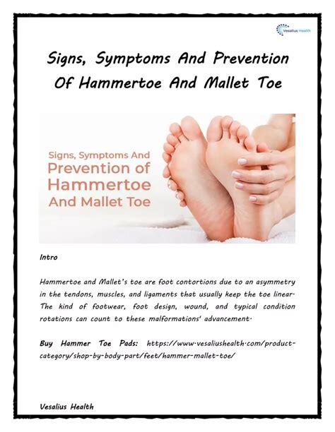 Ppt Signs Symptoms And Prevention Of Hammertoe And Mallet Toe