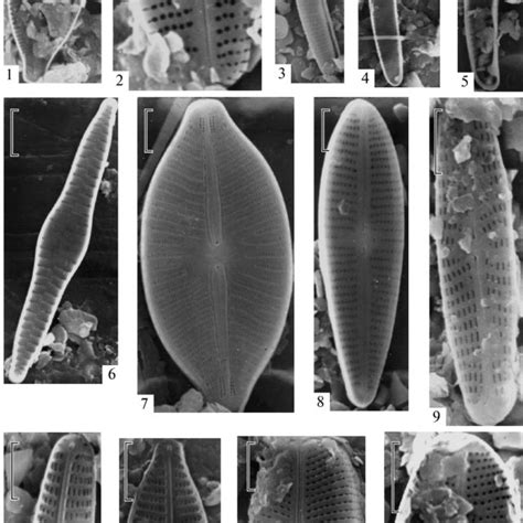 Electron Micrographs Of Valves Sem 1 Cymbopleura Lata Var
