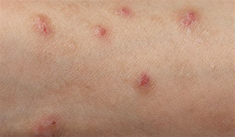 How To Soothe Itchy Skin Causes Symptoms And Treatments Edranks