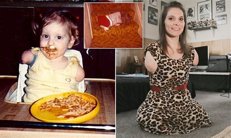 Woman Born With No Limbs Can Do Everything From Cooking To Driving
