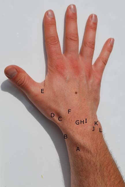 Wrist Pain Differential Diagnoses Wikimsk