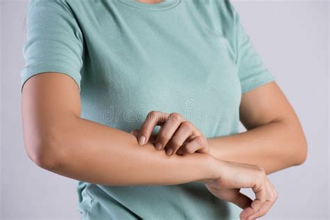 Close Up Woman Arm Scratch The Itch By Hand At Home Healthcare And