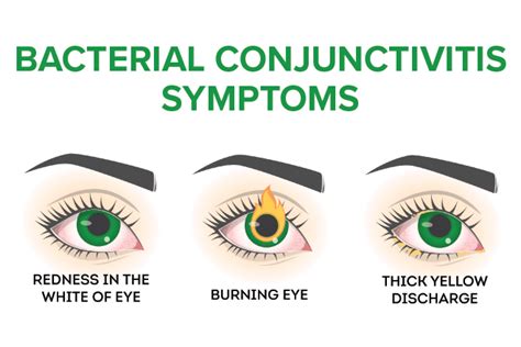 Signs And Symptoms Of Pink Eye Conjunctivitis
