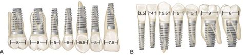 72 Clinical Evaluation Of The Implant Patient Pocket Dentistry