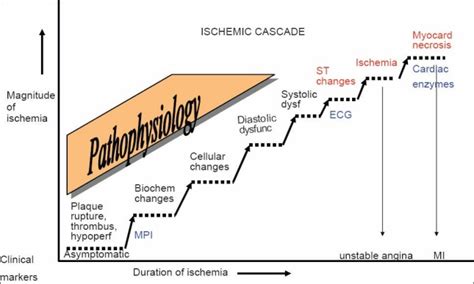 Depicts The Myocardial Ischemic Cascade And Stepwise Changes Which