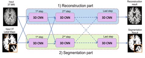 Brain Hemorrhage Segmentation With Deep Learning By Rsip Vision