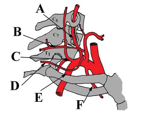 Download Branches of the subclavian artery (coloring book) | neuroanatomy | Pinterest | Subclavian artery
