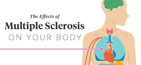 The Effects Of Multiple Sclerosis On Your Body